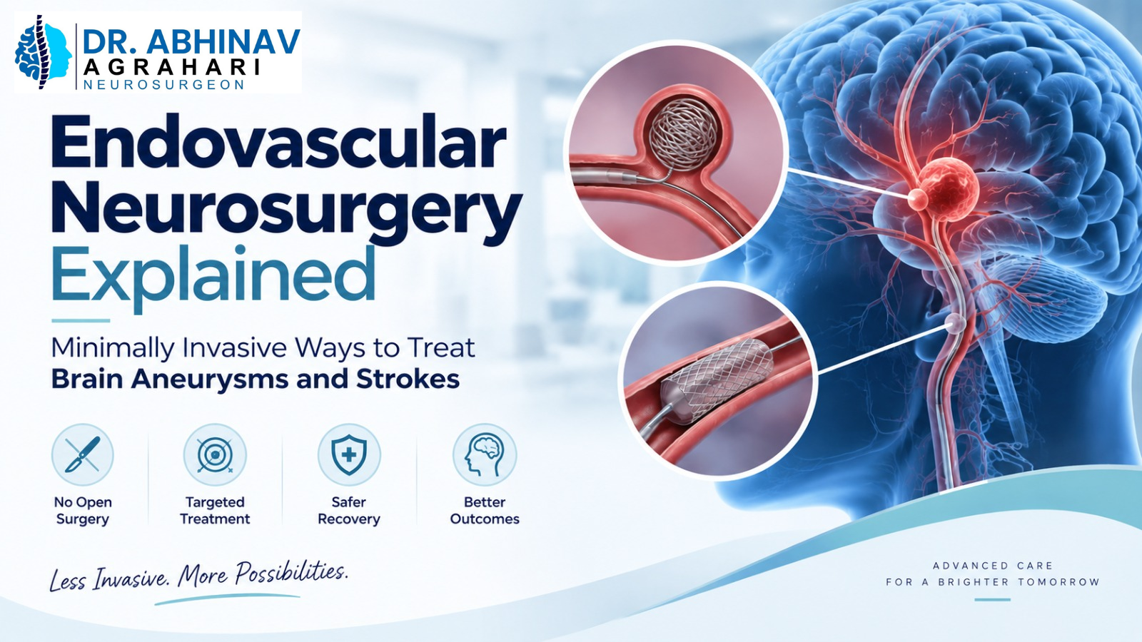 Endovascular Neurosurgery Explained: Minimally Invasive Ways to Treat Brain Aneurysms and Strokes